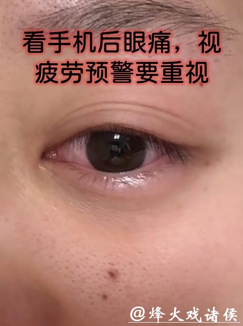 长期侧躺刷手机有多伤眼? 眼科医生陶勇提醒
